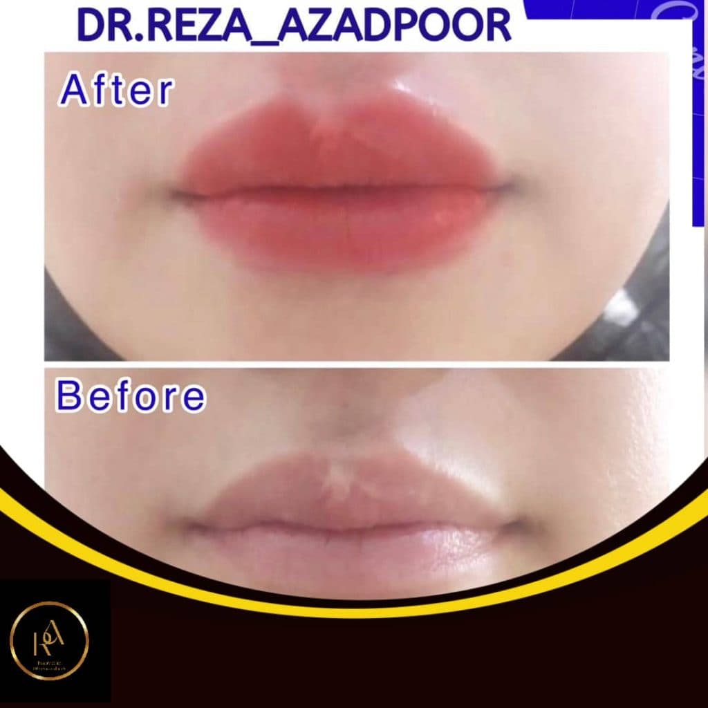 دکتر محمدرضا آزادپور در معالی آباد شیراز