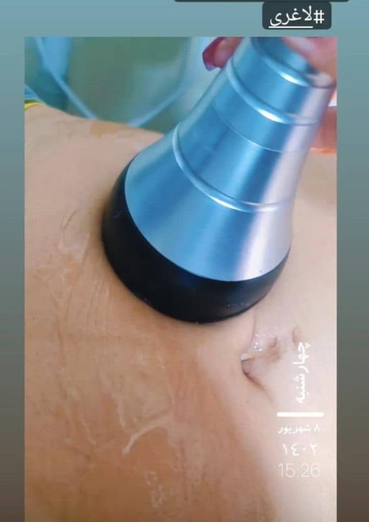 مرکز تخصصی لیزر و زیبایی فشیال و لاغری لیلا خوشرو در معالی آباد شیراز