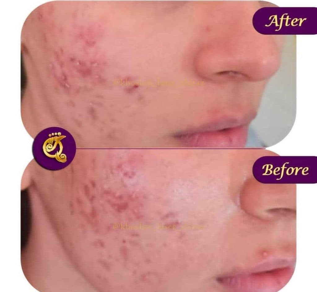 مرکز تخصصی لیزر و زیبایی فشیال و لاغری لیلا خوشرو در معالی آباد شیراز