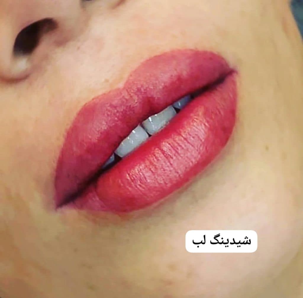 کلینیک تخصصی زیبایی پوست مو و لیزر دیارا در اردبیل