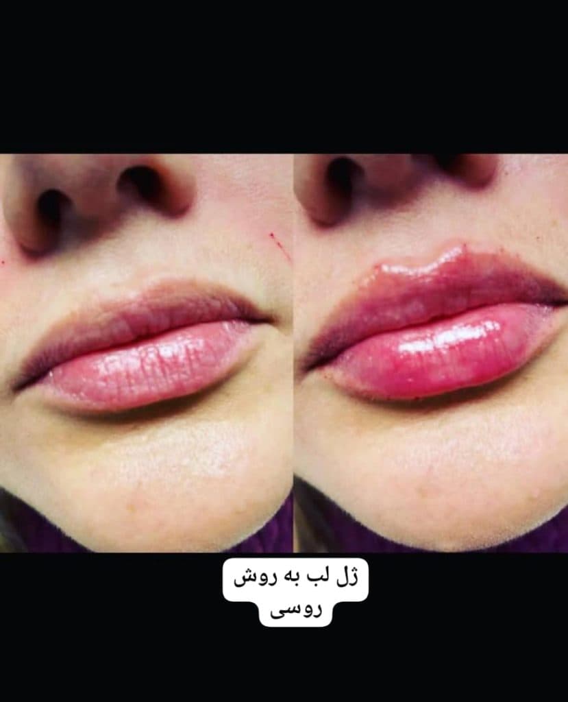 کلینیک تخصصی زیبایی پوست مو و لیزر دیارا در اردبیل