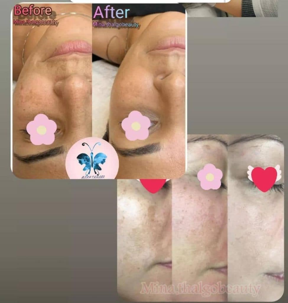 کلینیک زیبایی پوست و مو و لاغری و لیزر ماه مینا در شاهد شیراز