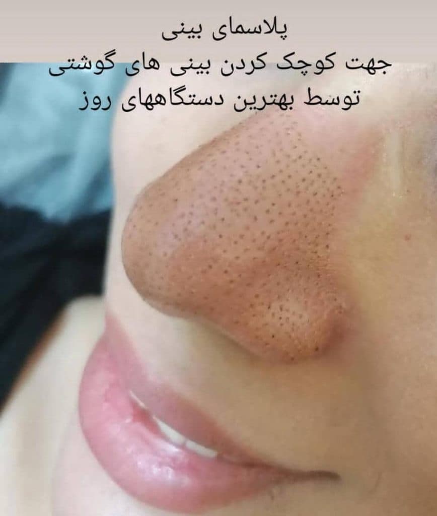 کلینیک زیبایی پوست و مو و لاغری و لیزر ماه مینا در شاهد شیراز