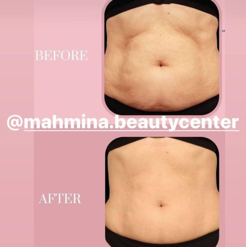 کلینیک زیبایی پوست و مو و لاغری و لیزر ماه مینا در شاهد شیراز