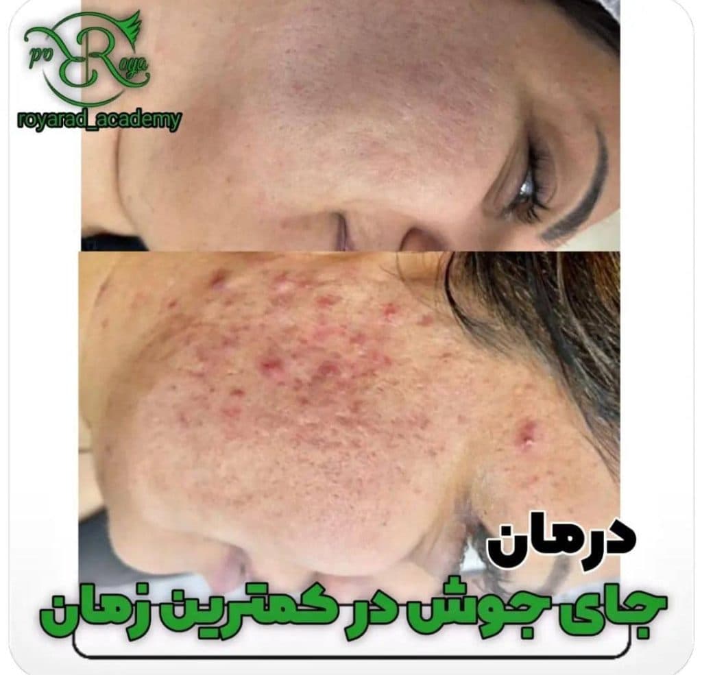 آکادمی تخصصی فیشیال و پاک سازی پوست و آرایش دائم رویا راد در شیراز