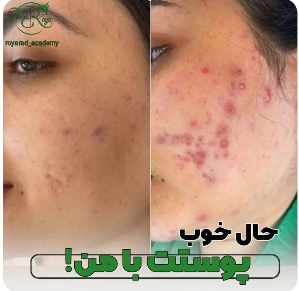 آکادمی تخصصی فیشیال و پاک سازی پوست و آرایش دائم رویا راد در شیراز