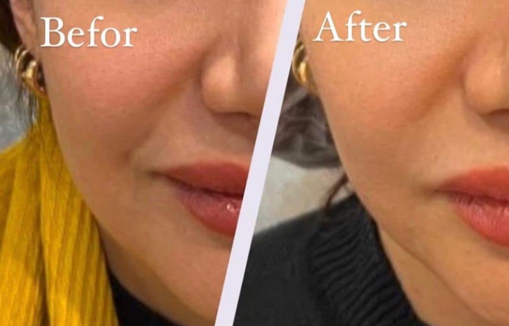 كلينيک زيبايي و پوست و مو رويايي در رفسنجان