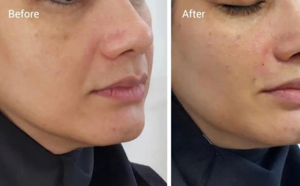 كلينيک زيبايي و پوست و مو رويايي در رفسنجان