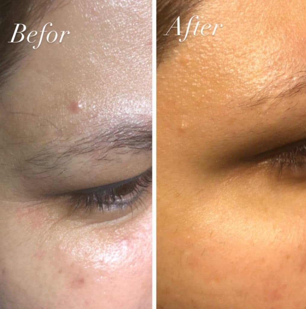 كلينيک زيبايي و پوست و مو رويايي در رفسنجان