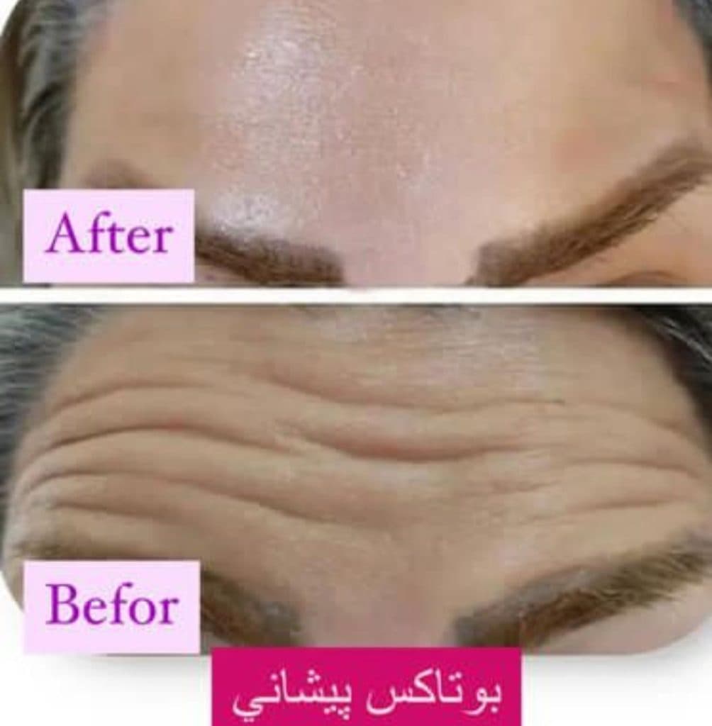 كلينيک زيبايي و پوست و مو رويايي در رفسنجان