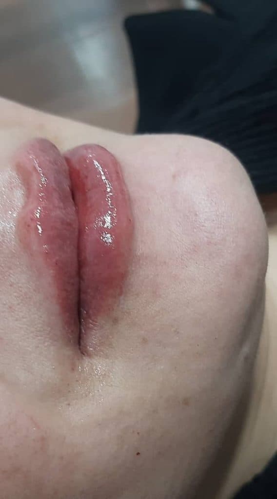 خدمات زیبایی پوست فشیال ژل و بوتاکس زارع در مرودشت شیراز