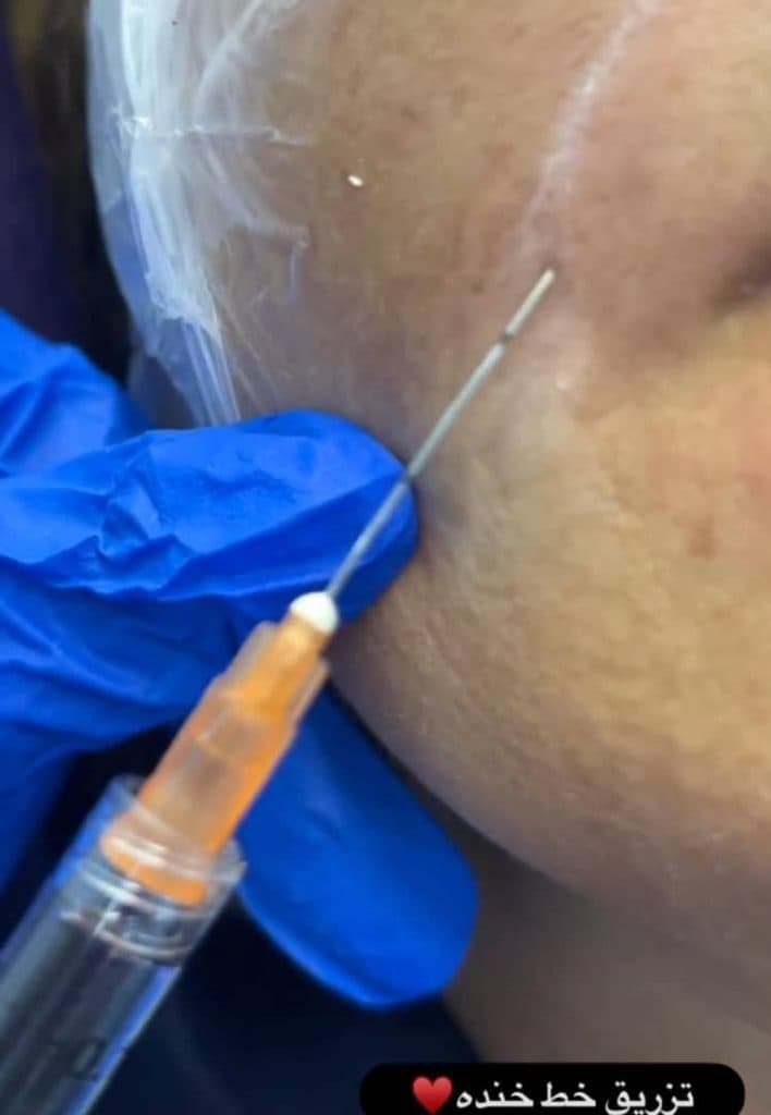 مرکز پزشکی و زیبایی لاغری فشیال و هوش مصنوعی سناتور در همدان