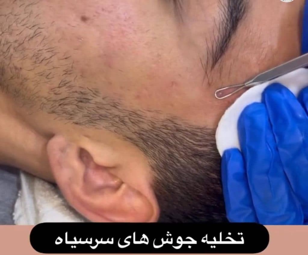 مرکز پزشکی و زیبایی لاغری فشیال و هوش مصنوعی سناتور در همدان