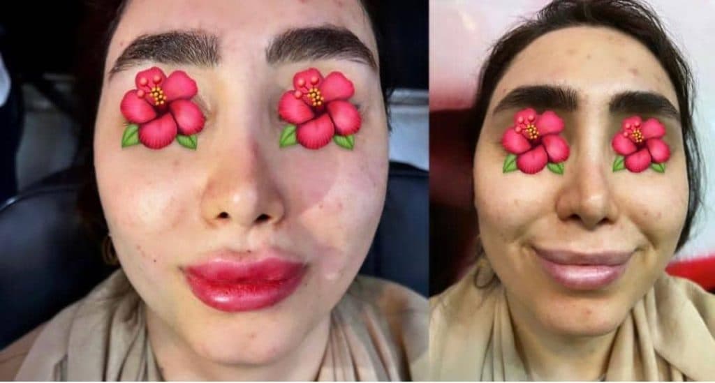 کلینیک آموزش و زیبایی فوق تخصصی ژل و بوتاکس آذین در ونک تهران