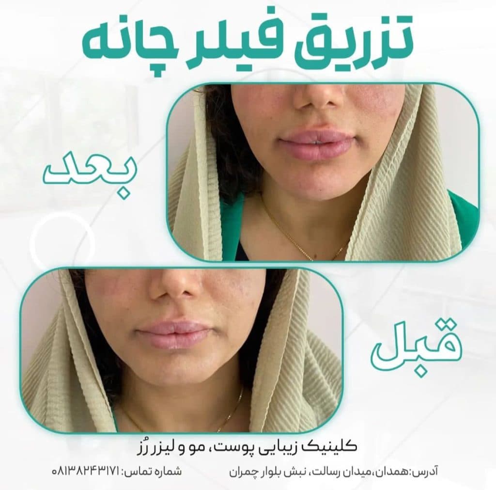 پزشک پوست و مو دکتر فاطمه قاسمی در همدان