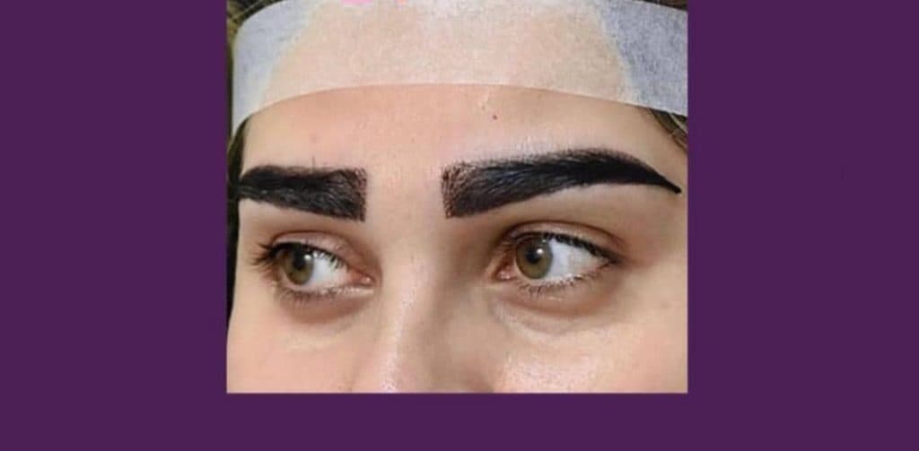 کلینیک تخصصی کاشت دائمی ابرو سحر اسدی در تهران