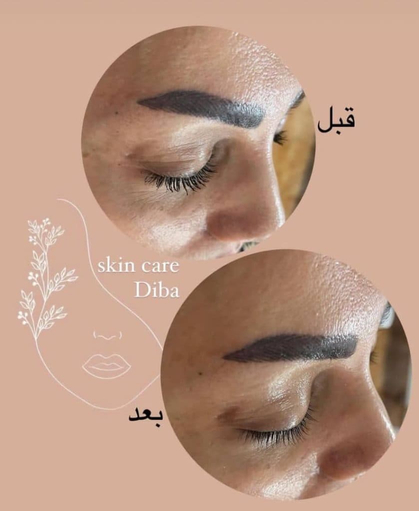 آموزش و خدمات تخصصی فیشیال و پاکسازی پوست دیبا پوررجب در رامسر