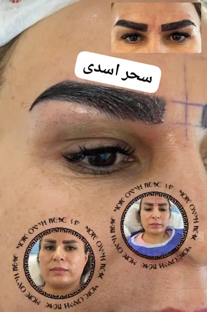 کلینیک تخصصی کاشت دائمی ابرو سحر اسدی در تهران