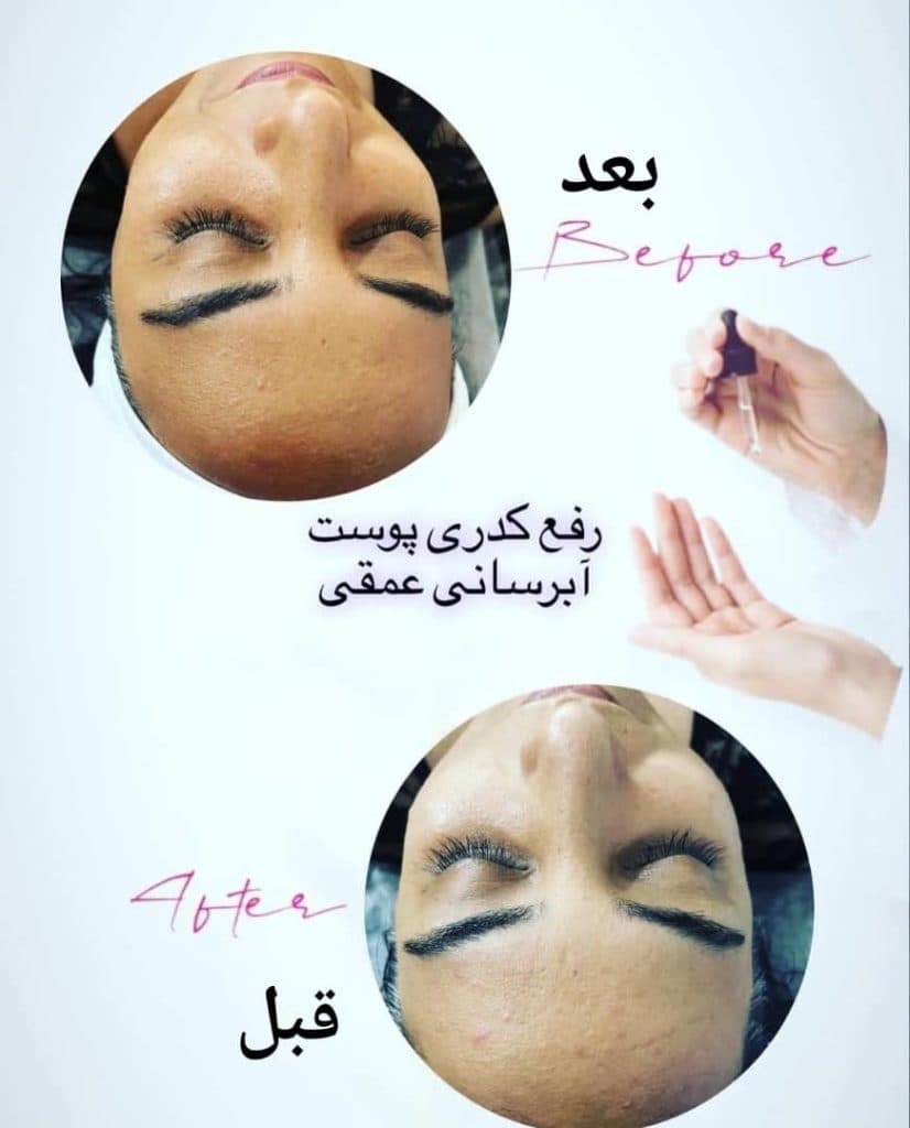 آموزش و خدمات تخصصی فیشیال و پاکسازی پوست دیبا پوررجب در رامسر