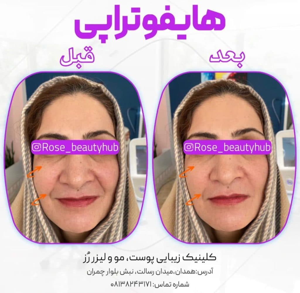 پزشک پوست و مو دکتر فاطمه قاسمی در همدان