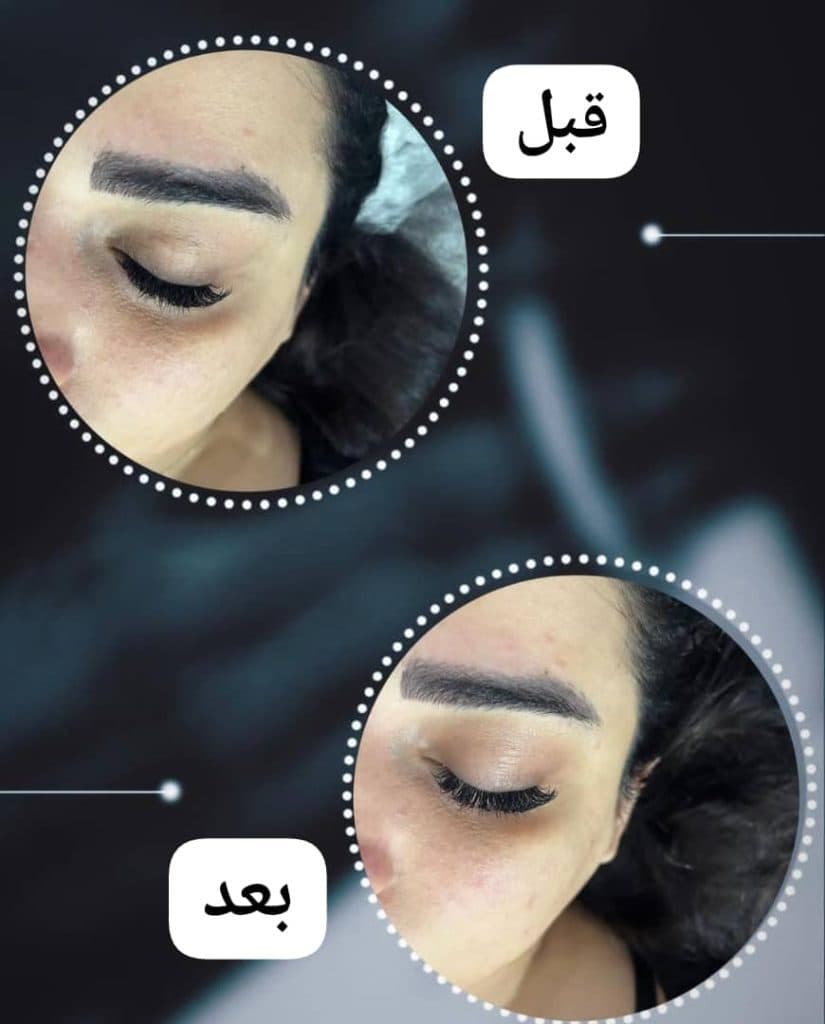 آموزش و خدمات تخصصی فیشیال و پاکسازی پوست دیبا پوررجب در رامسر