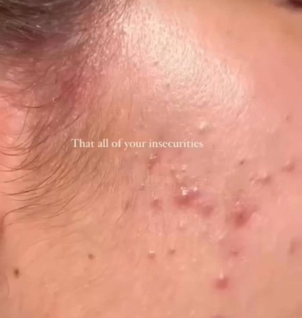 خدمات تخصصی فشیال پوست ماه در رحمت آباد شیراز