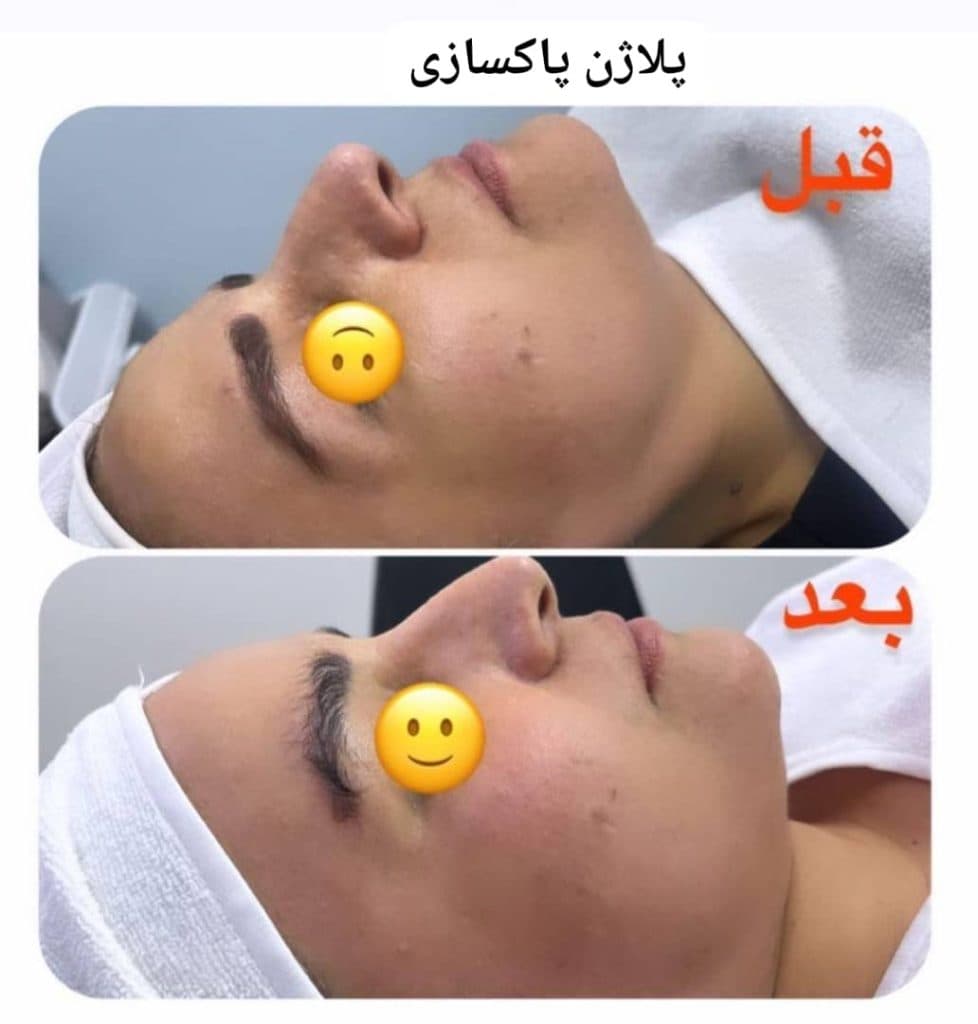 کلینیک تخصصی زیبایی پوست مو و لیزر پرنیا در جنت آباد مرکزی تهران