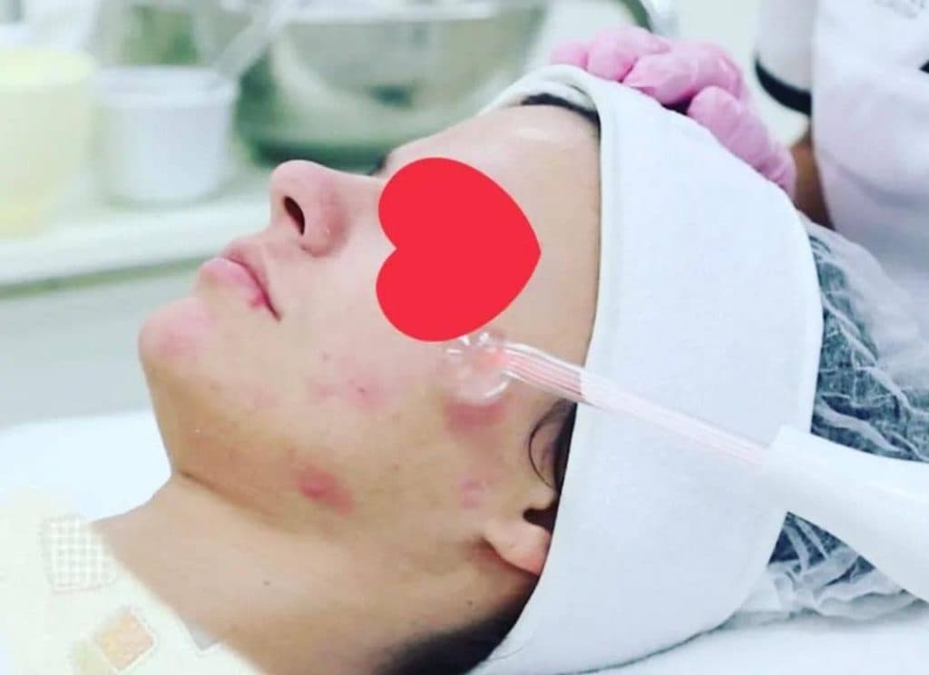 مرکز تخصصی و آموزشی فشیال و پاکسازی پوست شانا بیوتی در شیراز