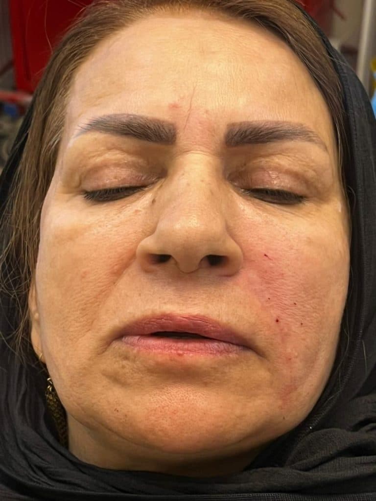 کلینیک زیبایی الیزه در یزد