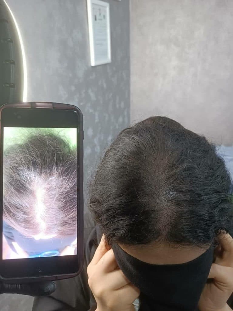 میکرواسکالپ پارسیان در اهواز