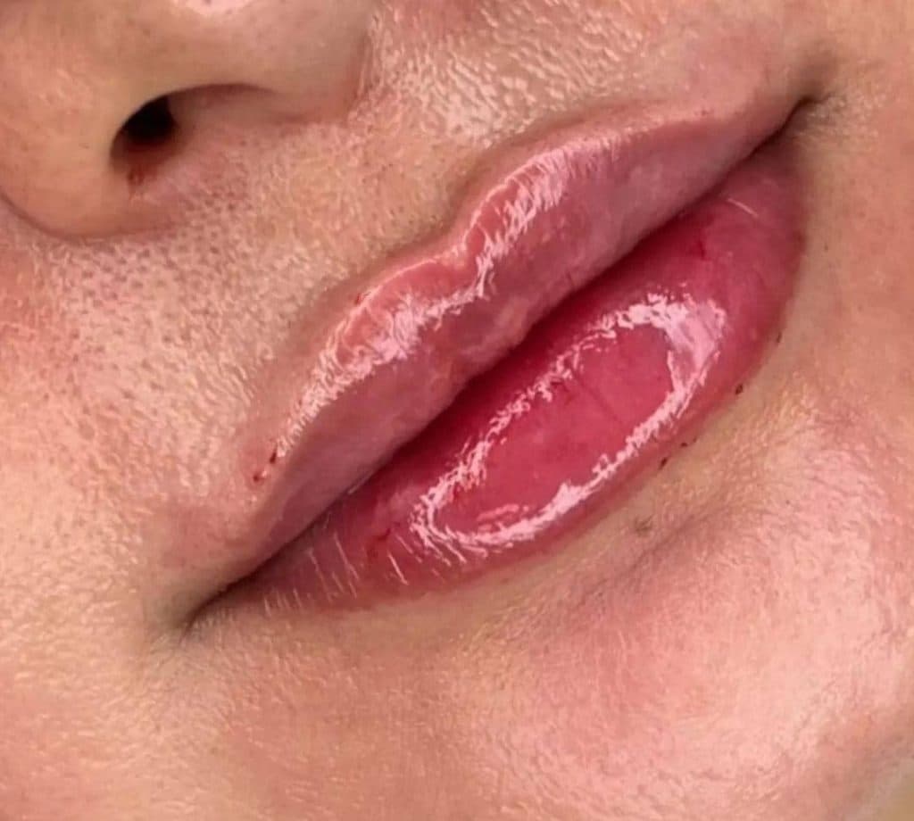 خدمات زیبایی تزریق ژل و بوتاکس افسون در بوکان آذربایجان غربی