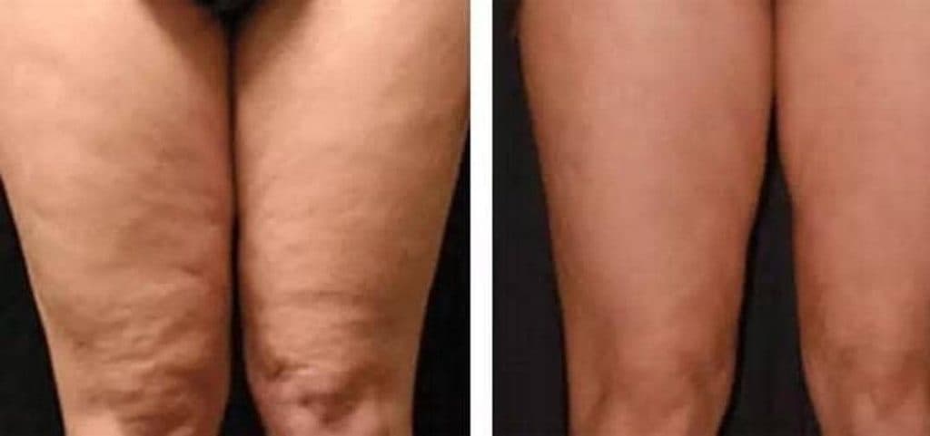 خدمات فیشیال تخصصی و ماساژ بدن و صورت ایوا در شیراز