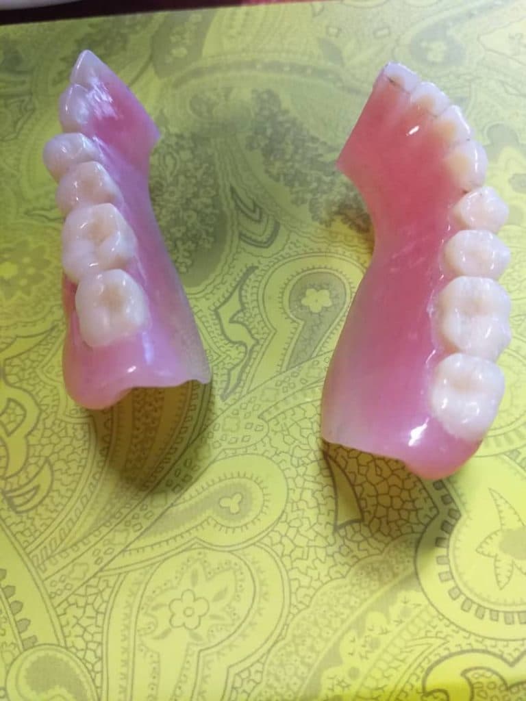 خدمات و تعمیر ترک خوردگی دندان مصنوعی دندانسازی دریا در صادقیه تهران