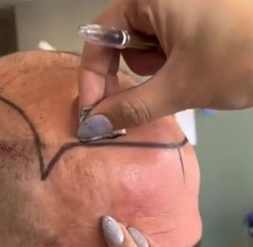 خدمات کاشت مو ریش ابرو الماس زیبایی در مشهد