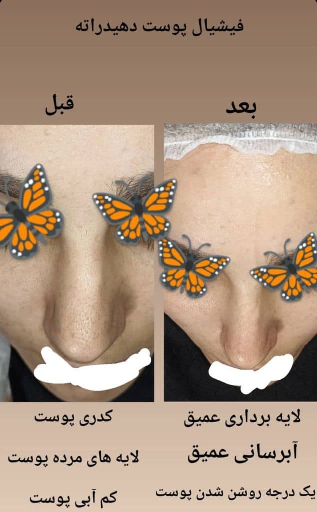 آموزش و خدمات فشیال تخصصی و پاکسازی پوست ساجده افضلی در مشهد