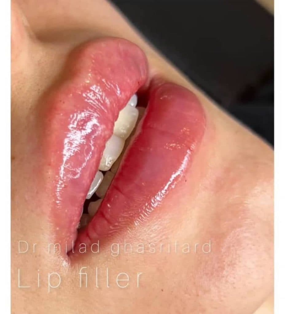 مرکز تخصصی زیبایی پوست و مو اسپرینگ در تهران