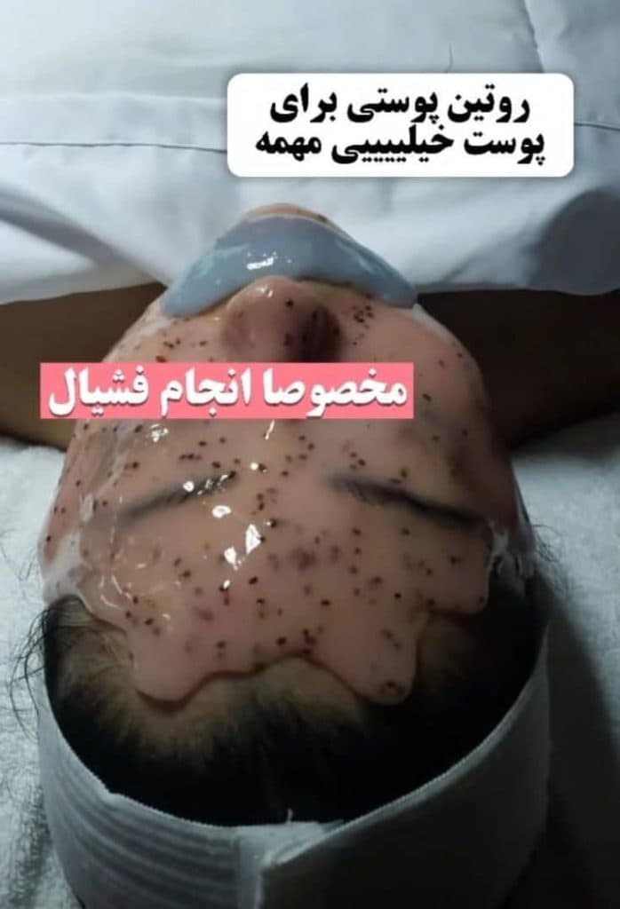 آموزش و خدمات تخصصی فشیال و درمان پوست مریم مینایی در تبریز