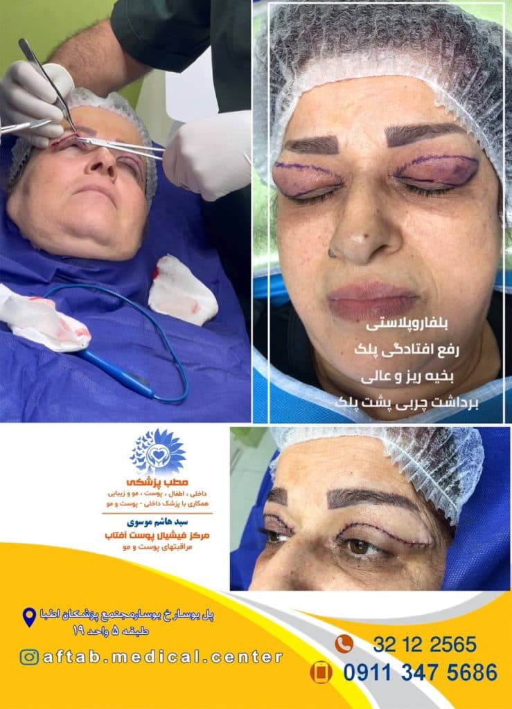 مطب پزشکی فشیال پوست آفتاب در رشت