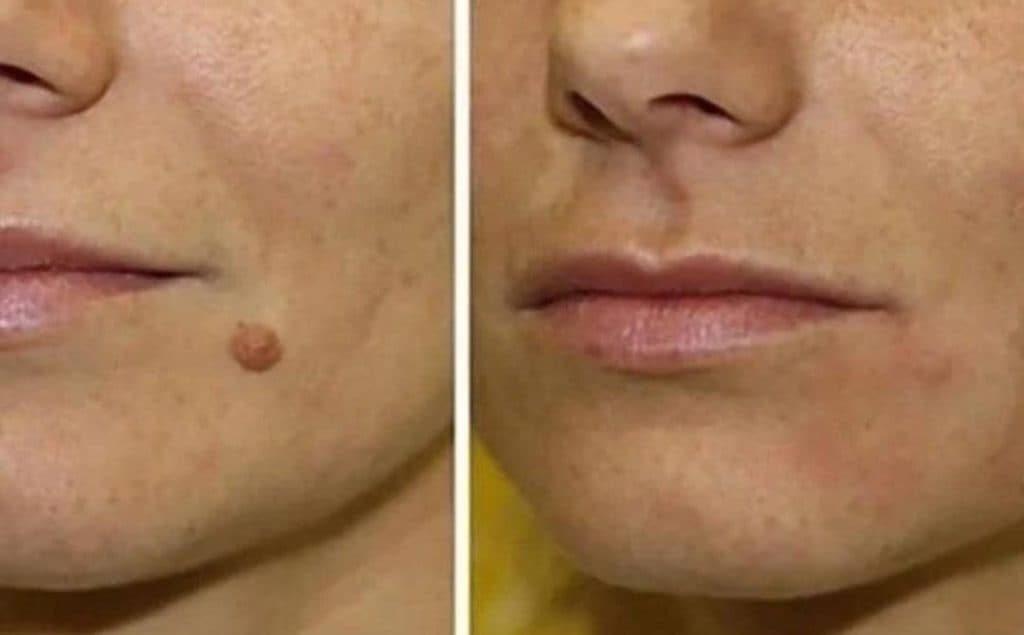 آموزش و خدمات تخصصی زیبایی و فشیال بوتاکس و مزونیدلینگ زمرد در شیراز