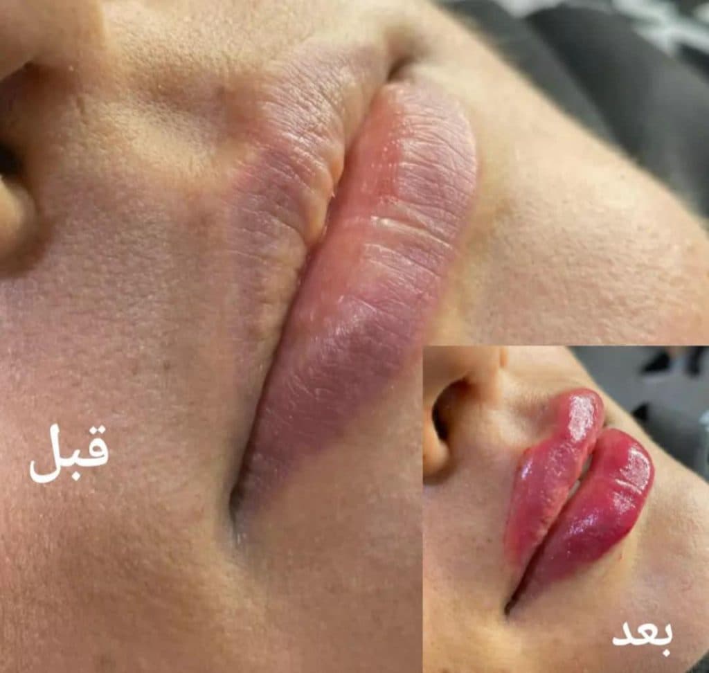 کلینیک زیبایی باران در قم