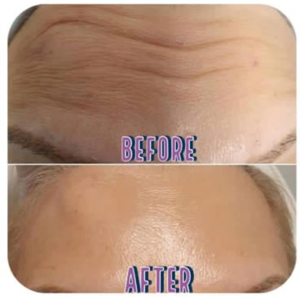 خدمات زیبایی اندولیفت و هایفو و بوتاکس مرکز زیبایی دکتر رحیمی در اصفهان