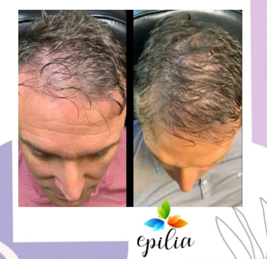 خدمات زیبایی اندولیفت و هایفو و بوتاکس مرکز زیبایی دکتر رحیمی در اصفهان