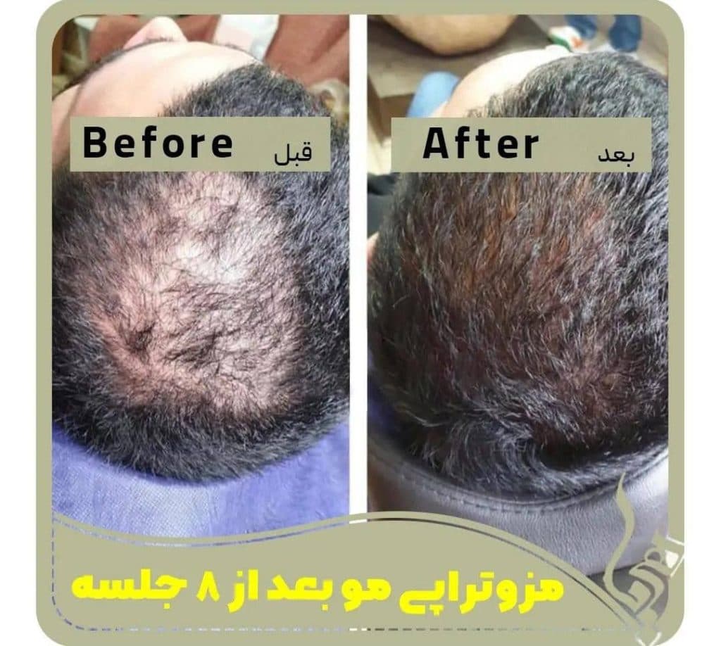 کلینیک زیبایی پوست و مو هیما سنتر در تهران