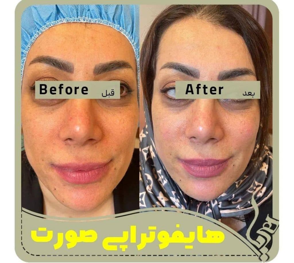 کلینیک زیبایی پوست و مو هیما سنتر در تهران