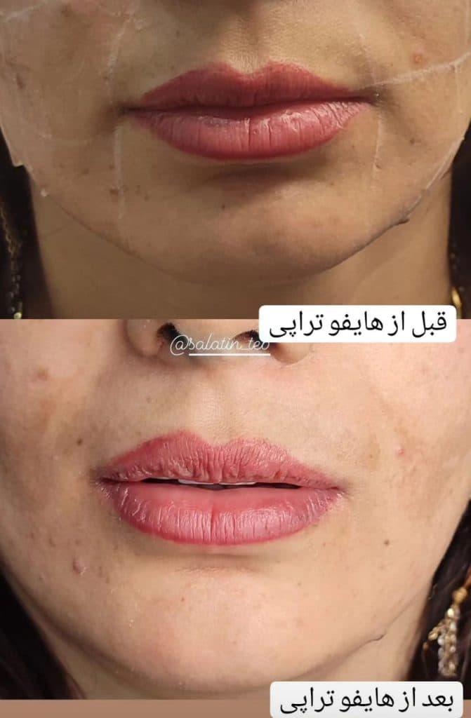 کلینیک زیبایی و لیزر سلاطین طب در زرند کرمان