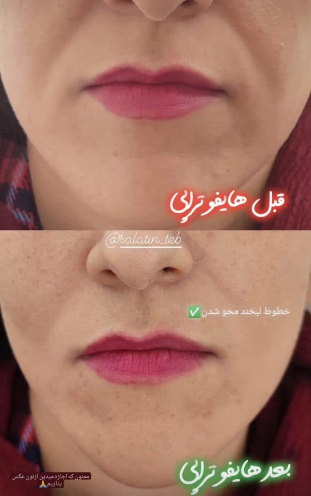 کلینیک زیبایی و لیزر سلاطین طب در زرند کرمان