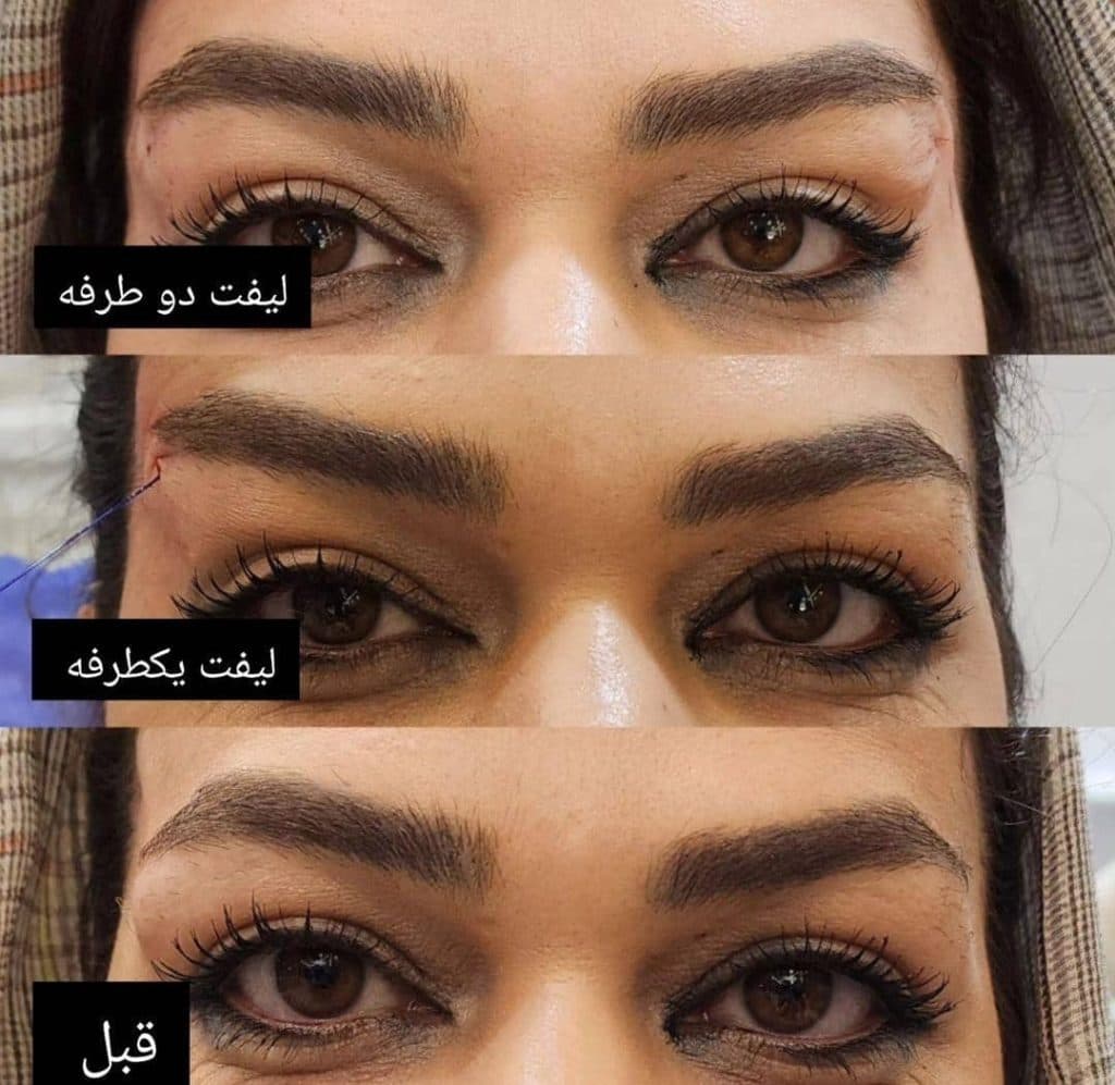 خدمات بوتاکس و ژل لب و لیزر کندلا دکتر امین بشردوست در ملایر همدان