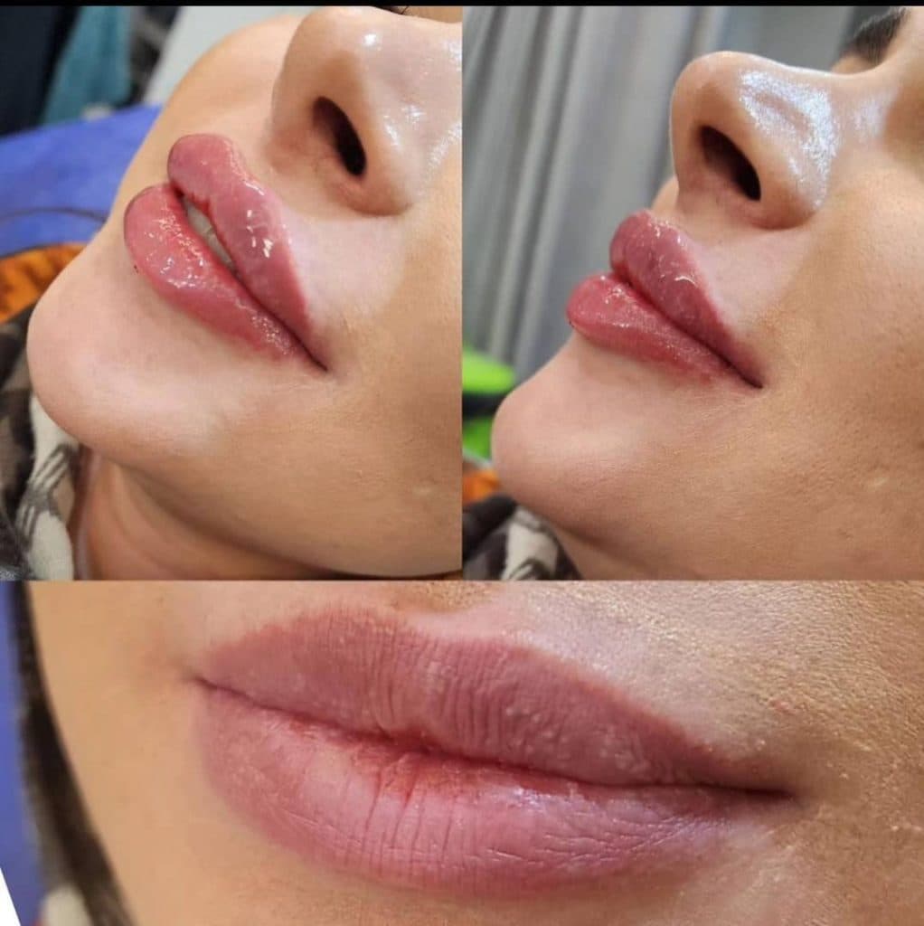 خدمات بوتاکس و ژل لب و لیزر کندلا دکتر امین بشردوست در ملایر همدان