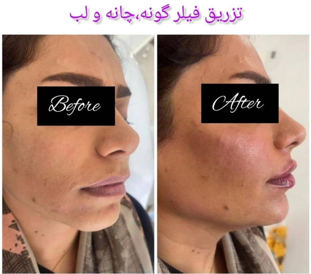 خدمات بوتاکس و ژل لب و لیزر کندلا دکتر امین بشردوست در ملایر همدان