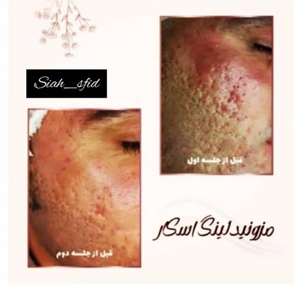 سالن زیبایی vip مردانه سیاه سفید در ملایر